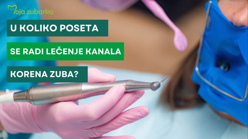 U koliko poseta se radi lečenje kanala korena zuba? • Moja Zubarka