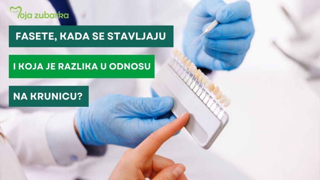 Fasete, kada se stavljaju i koja je razlika u odnosu na krunicu?
