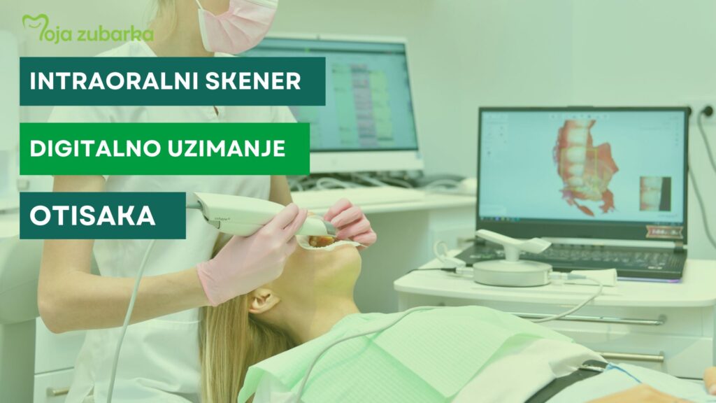 Intraoralni skener - Digitalno uzimanje otisaka • Moja Zubarka